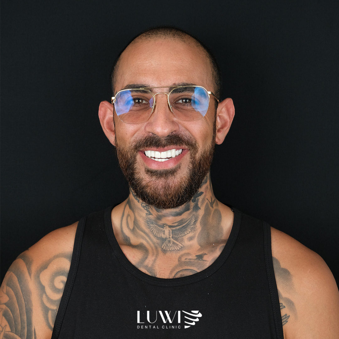 Dental Veneers - Luwi Dental Clinic