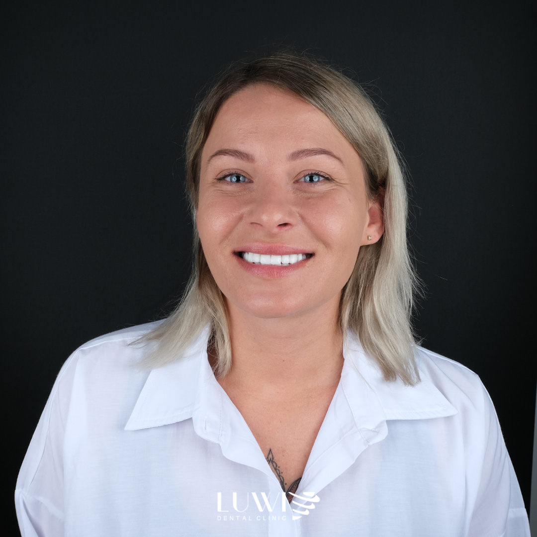 Hollywood Smile - Luwi Dental Clinic