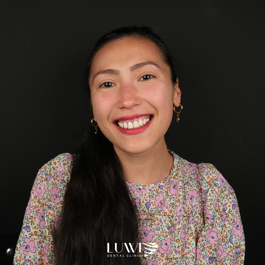 Zirconia Crowns - Luwi Dental Clinic