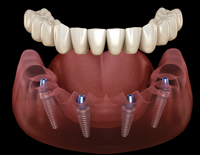 Luwi Dental Clinic - Photo 6