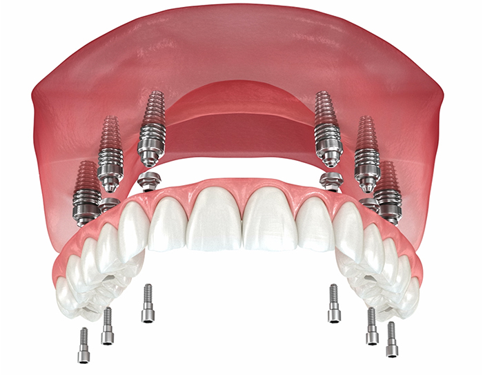 Luwi Dental Clinic - Photo 7
