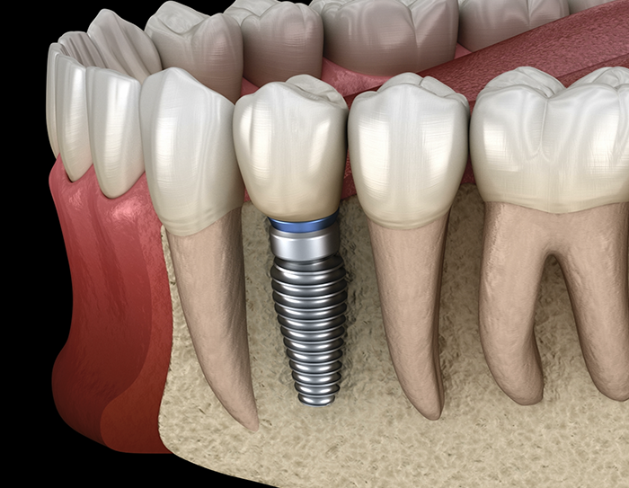 Luwi Dental Clinic - Photo 4