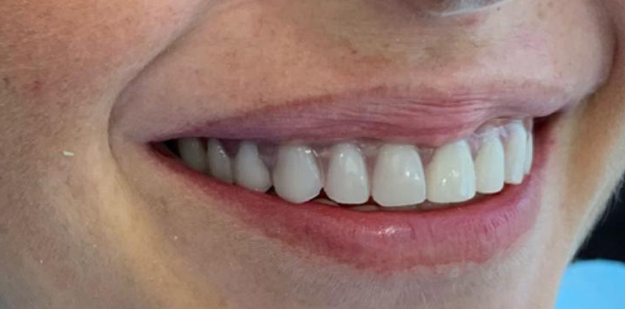 Smile Design - Tasarım Dental Clinic