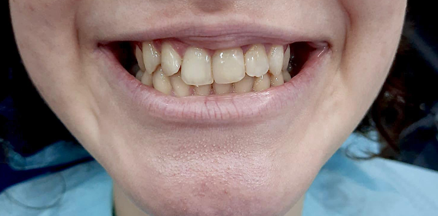 Smile Design - Tasarım Dental Clinic