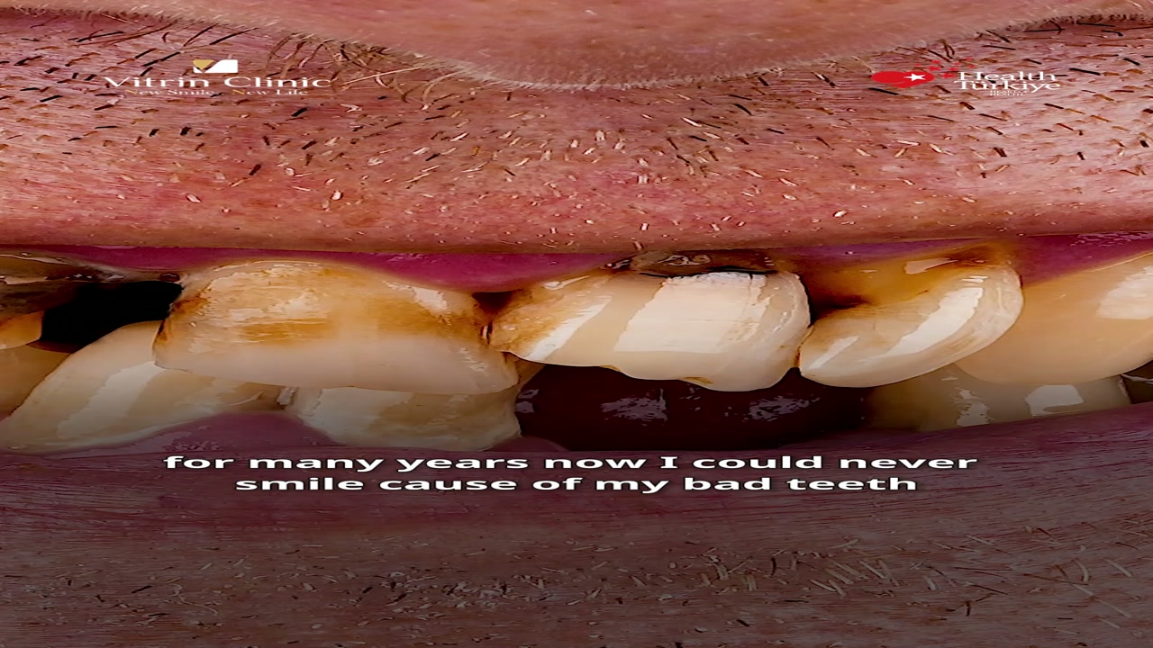 Graeme's Treatment Story